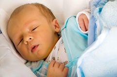 what causes yellow jaundice in newborns