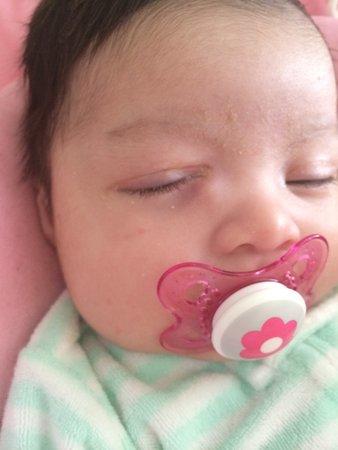 blocked tear duct infant